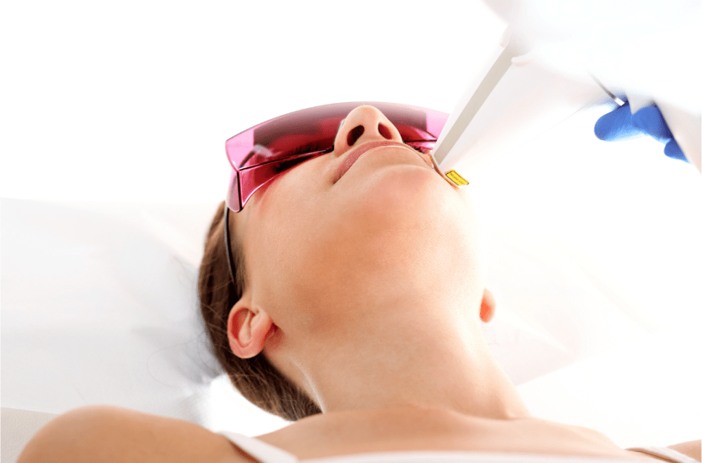 Laser Hair Removal Areas Available