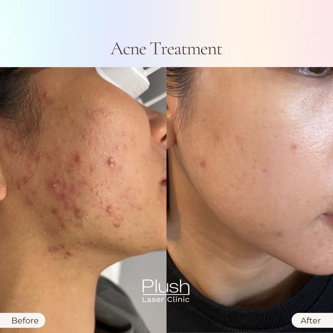 Plush Laser Clinic