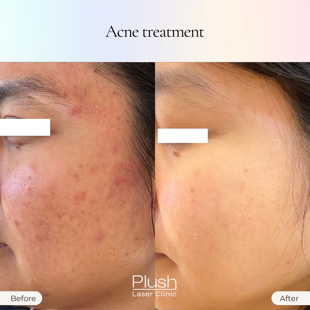 Plush Laser Clinic