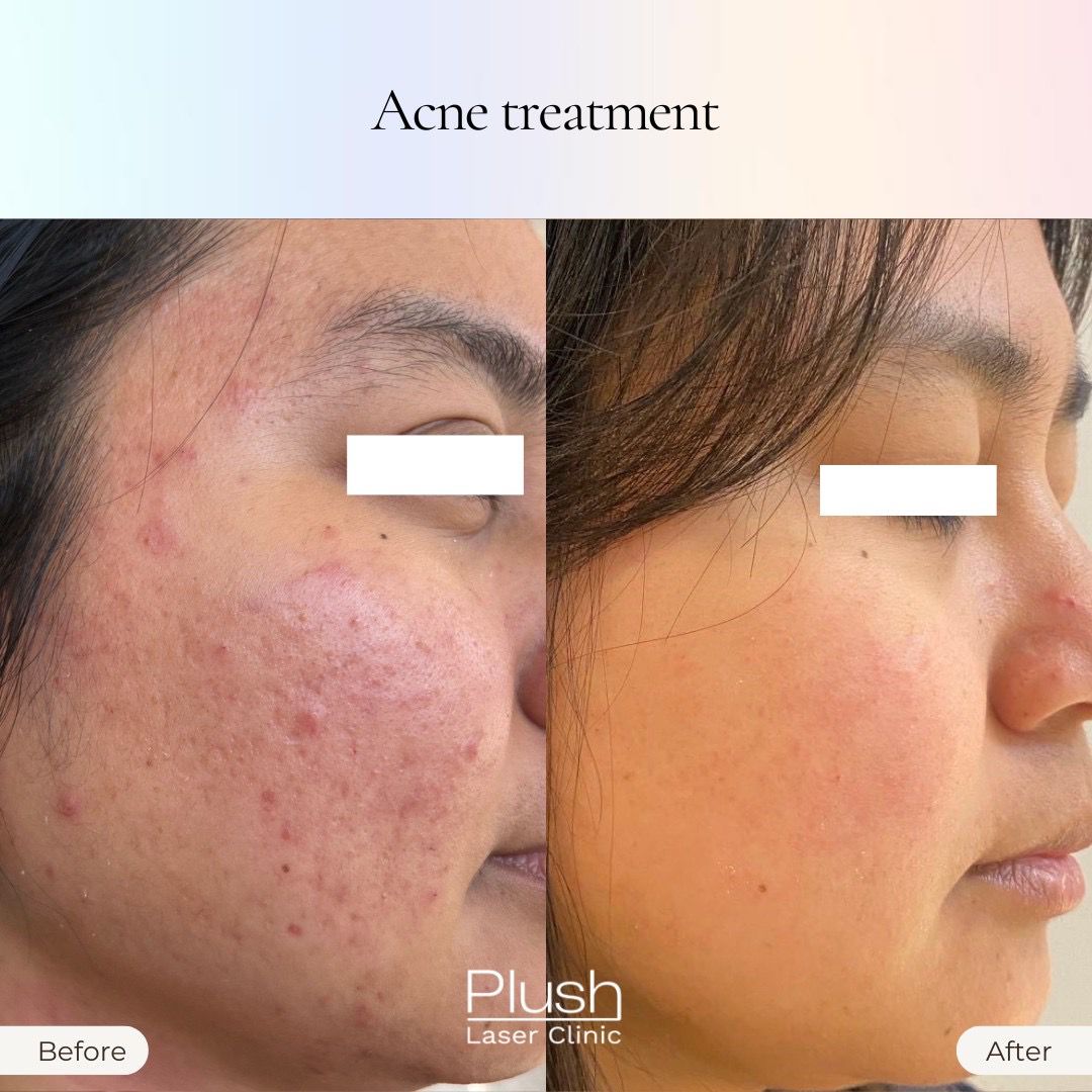 Plush Laser Clinic