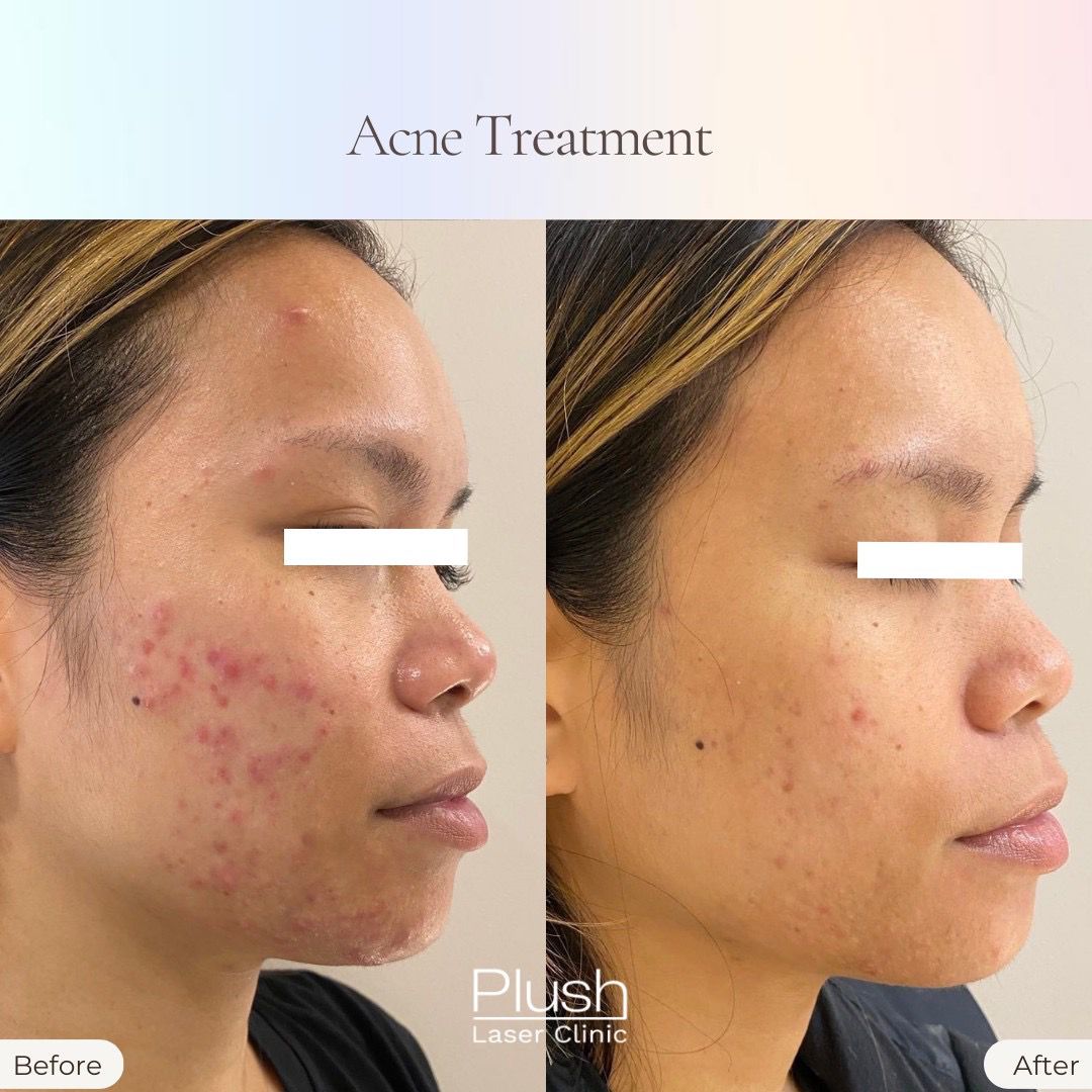 Plush Laser Clinic