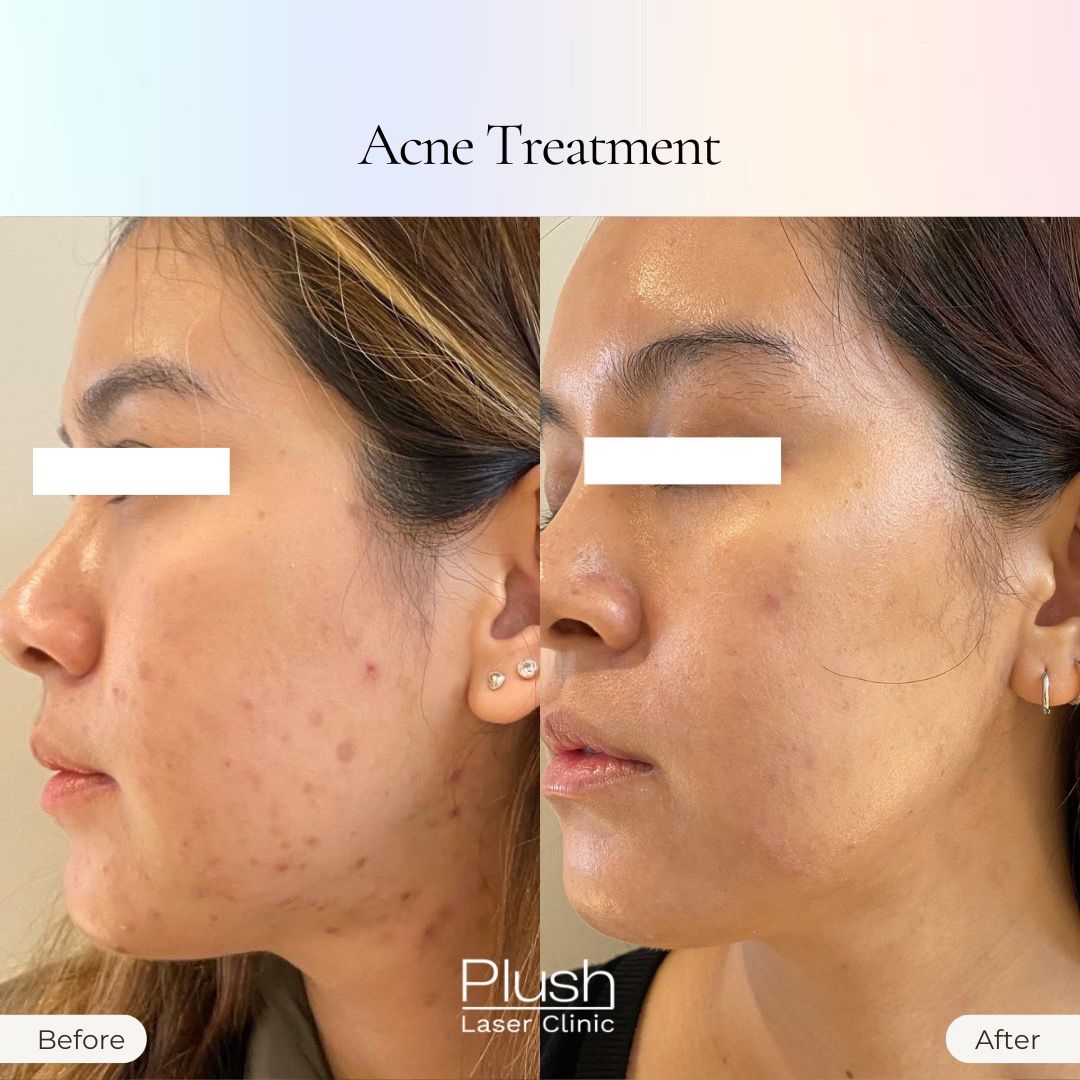 Plush Laser Clinic