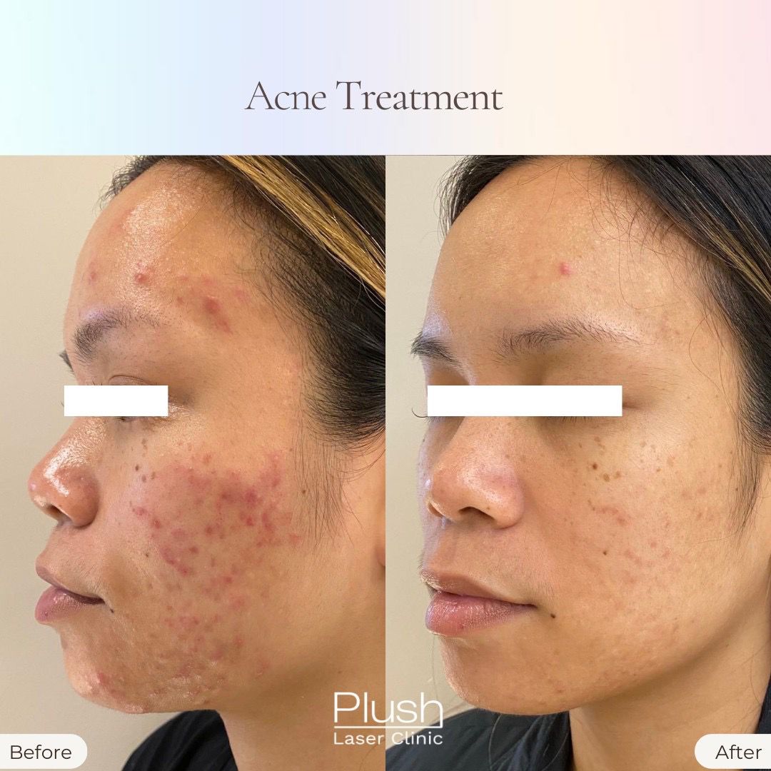 Plush Laser Clinic