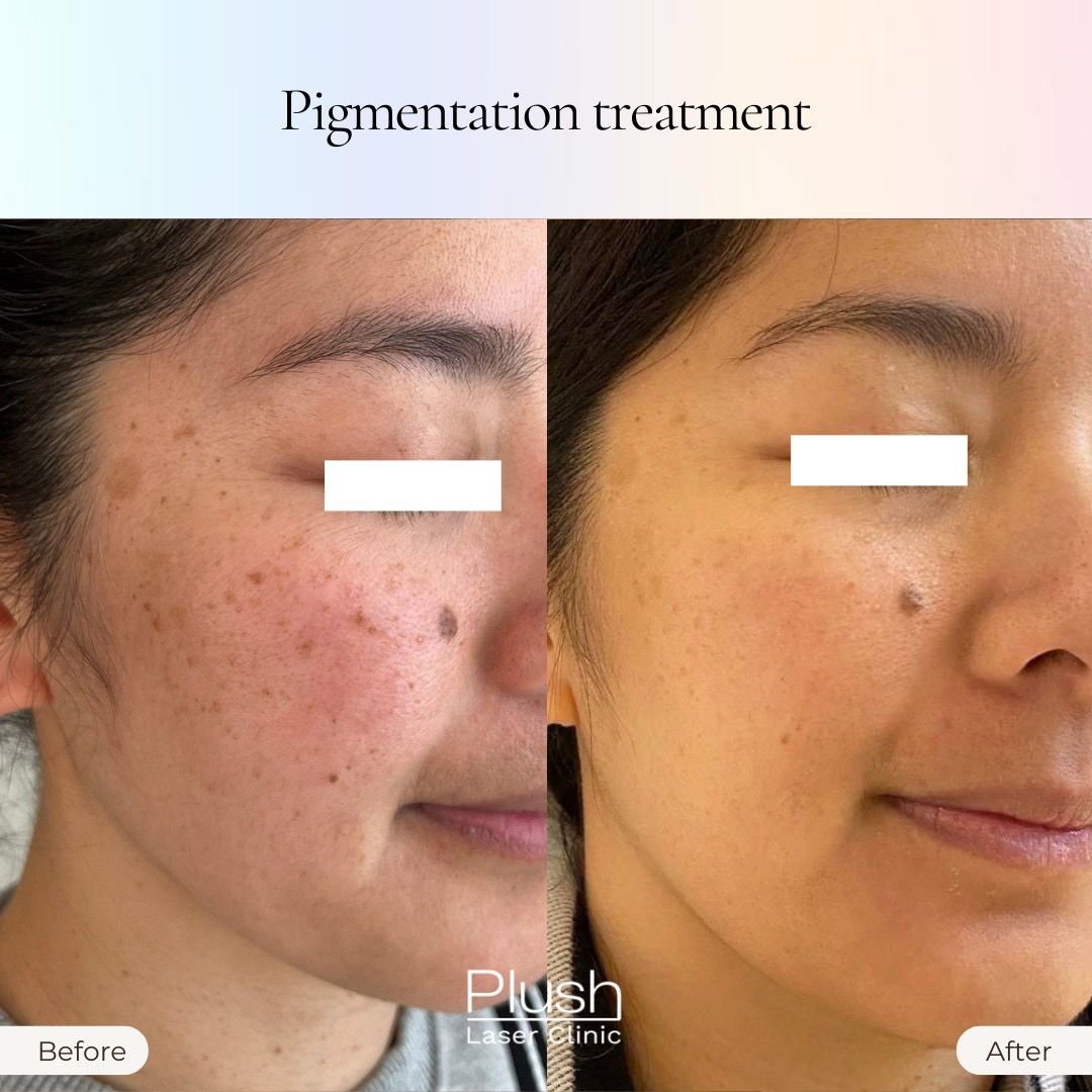Plush Laser Clinic