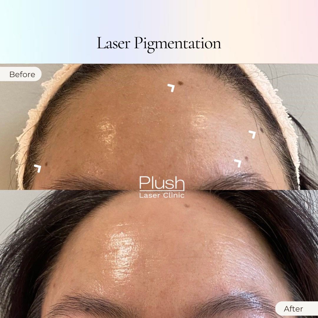 Plush Laser Clinic