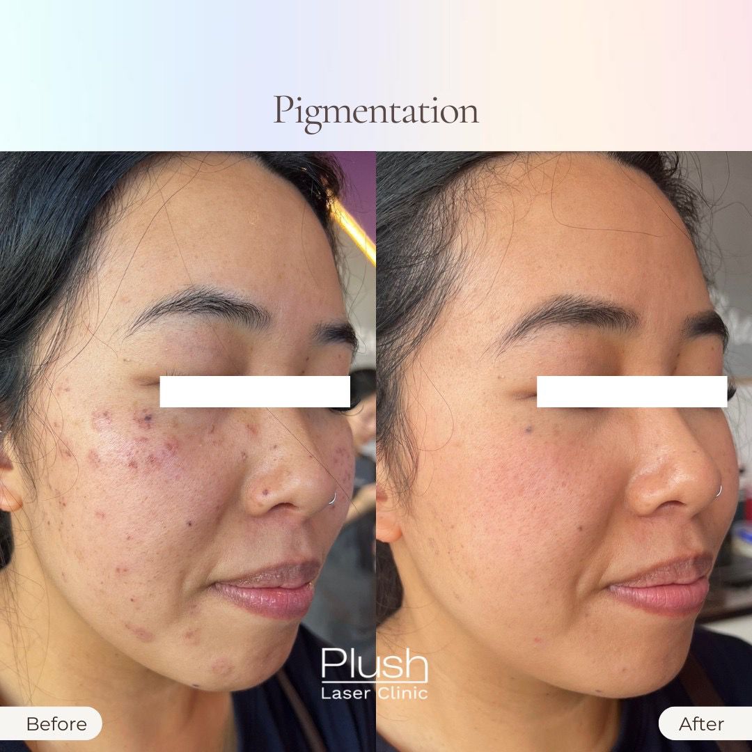 Plush Laser Clinic