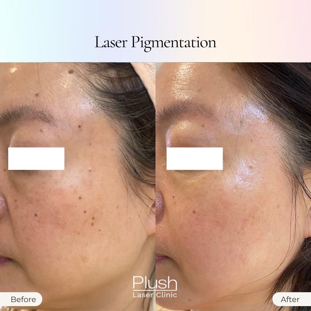 Plush Laser Clinic