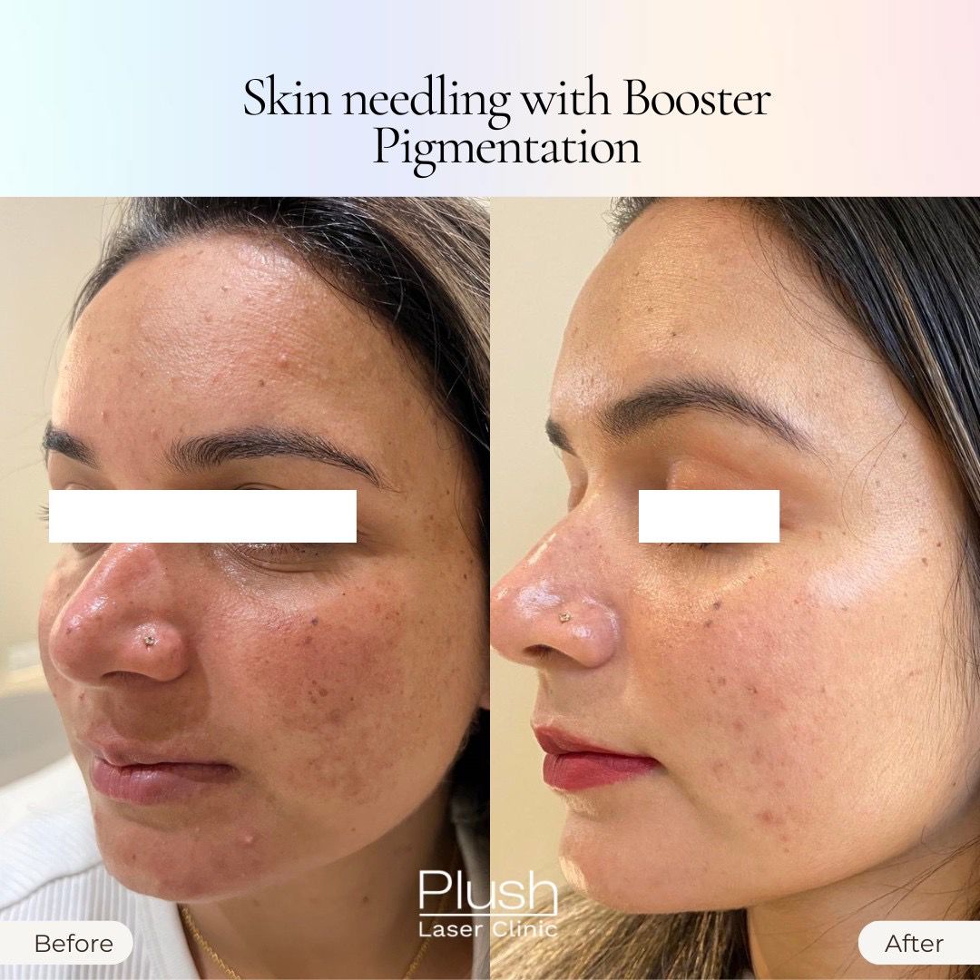 Plush Laser Clinic