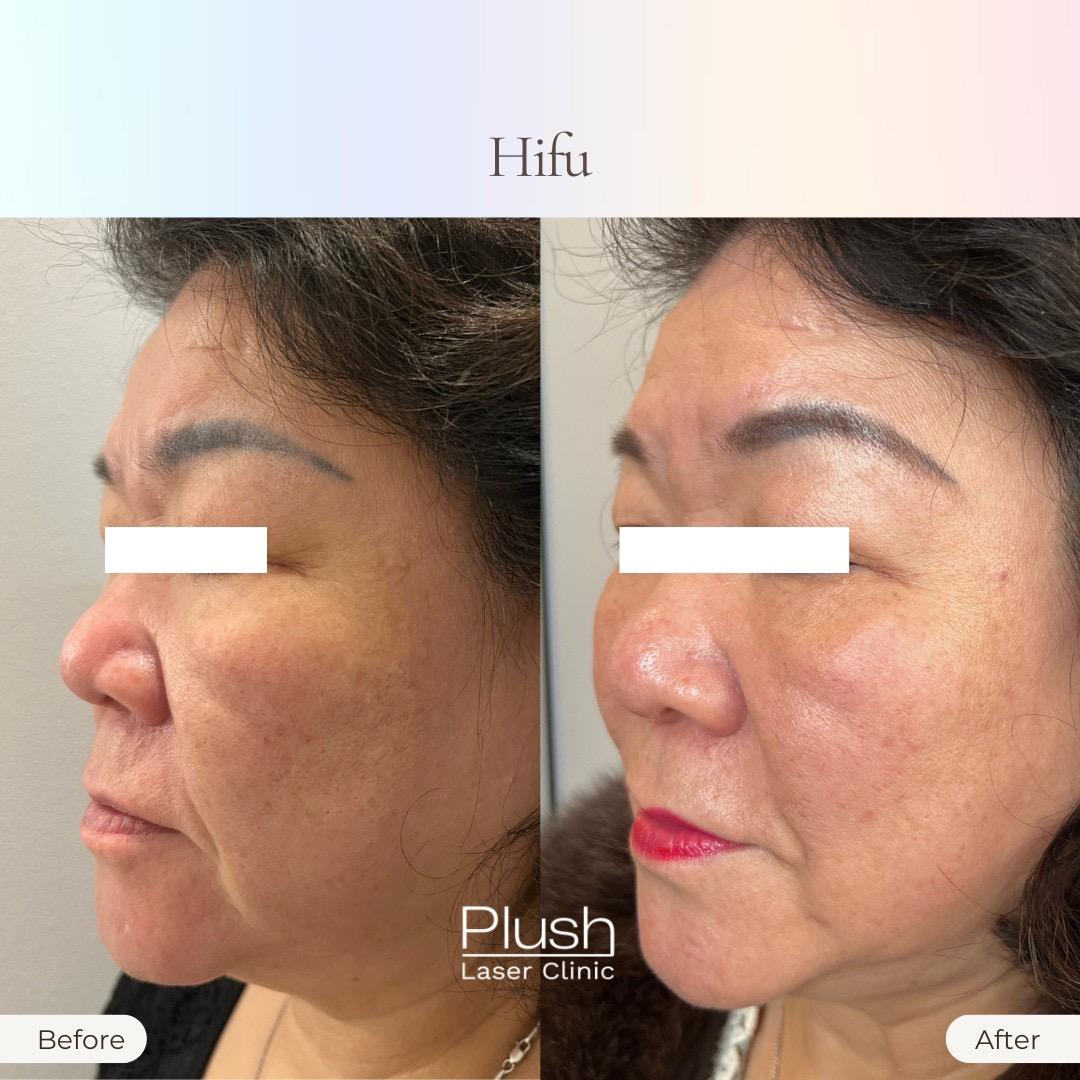 Plush Laser Clinic