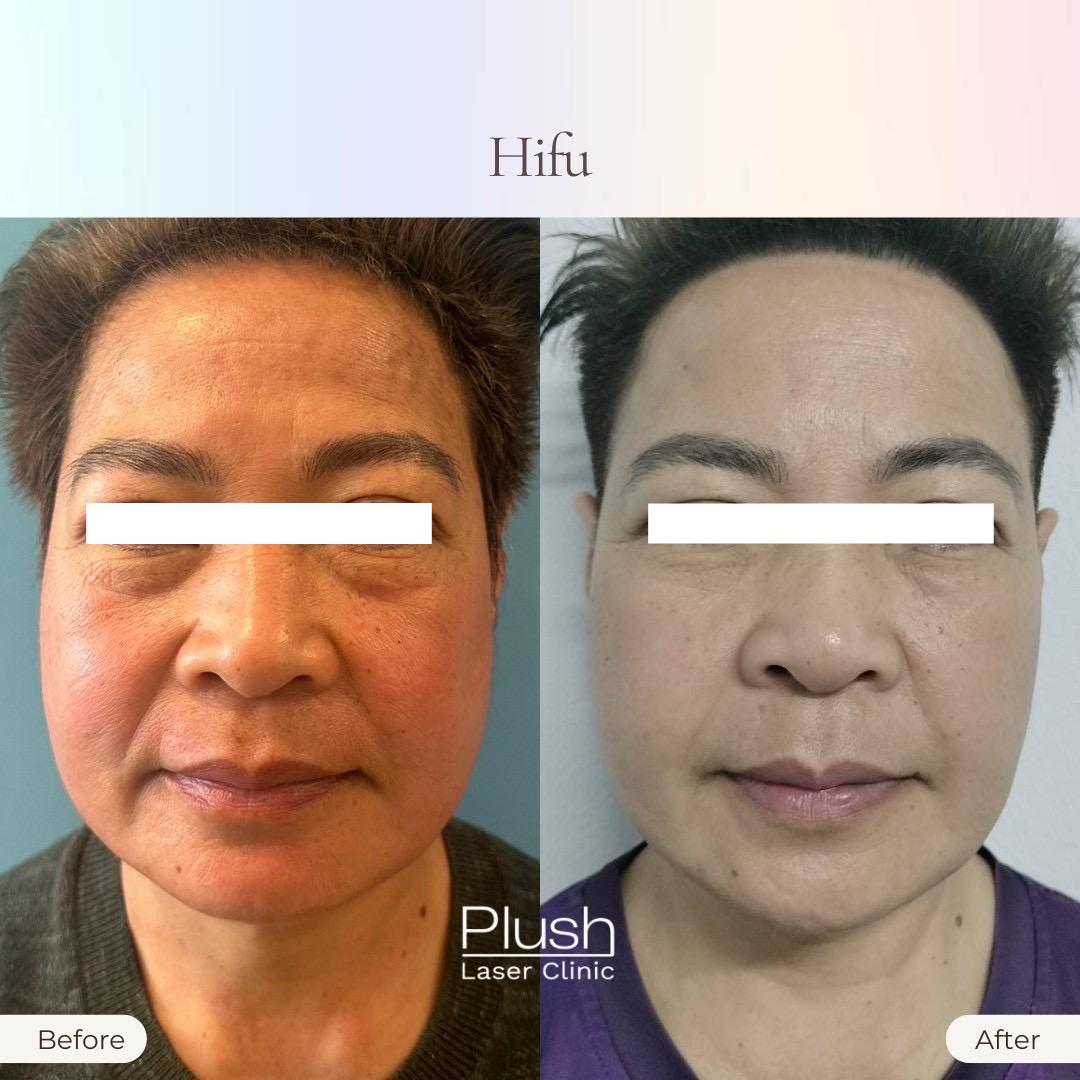Plush Laser Clinic