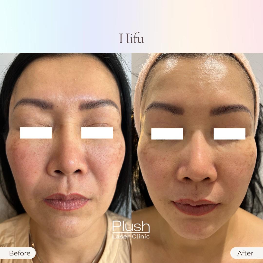 Plush Laser Clinic